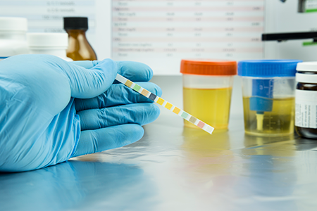 Specimen testing
