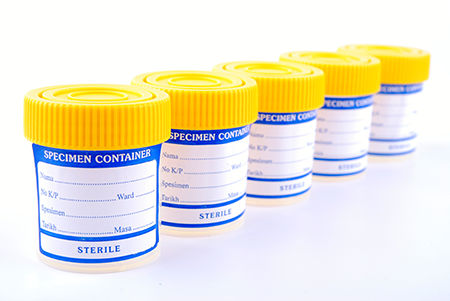 Specimen containers